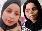 هكذا انكسرت الطفولة.. واحترق النور في عين "ندى"!