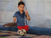 طفل وُلد فاقدًا ثلاثة أطراف يتمسك بحلمه في لعب كرة القدم