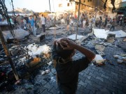 أطفالٌ أحرقتهم نيران النزوح.. والخيمة "فتيل" الحكاية!