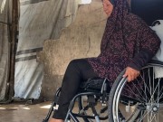 بعد بتر قدمها.. نهاد تواجه حياة جديدة وسط ظروف قاسية